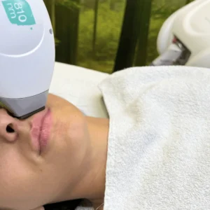 epilazione-laser-baffetti-cinquefrondi