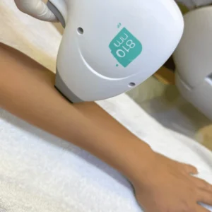 epilazione-laser-braccio-cinquefrondi