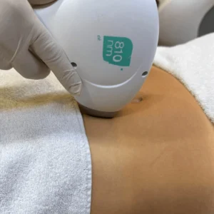epilazione-laser-cinquefrondi-addome