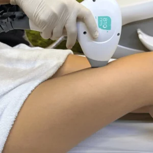 epilazione-laser-gambe-cinquefrondi