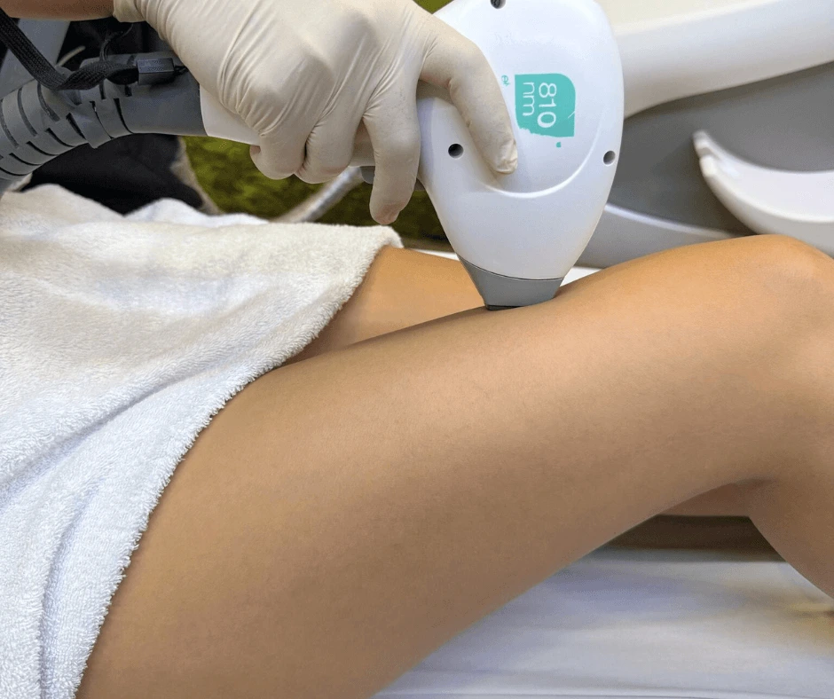epilazione-laser-gambe-cinquefrondi