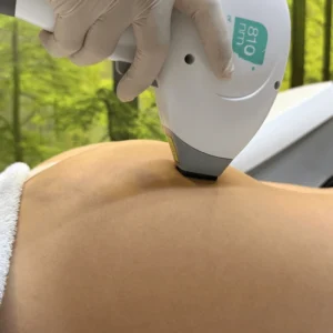 epilazione-laser-glutei-cinquefrondi