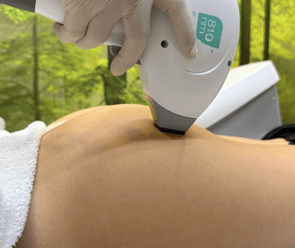 epilazione-laser-glutei-cinquefrondi