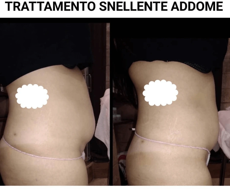 pancia-piatta-con-trattamento-snellente-a-cinquefrondi