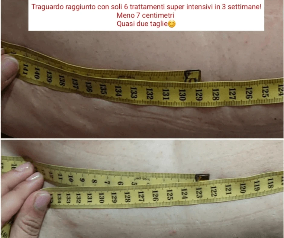 perdita-di-centimetri-intorno-al-girovita-con-trattamento-rimodellante-corpo-a-cinquefrondi