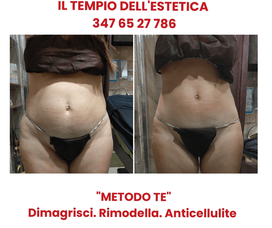 trattamento-snellente-addome-senza-dieta-estrema-con-il-metodo-te-prima-e-dopo-pancia-piatta-e-tonica